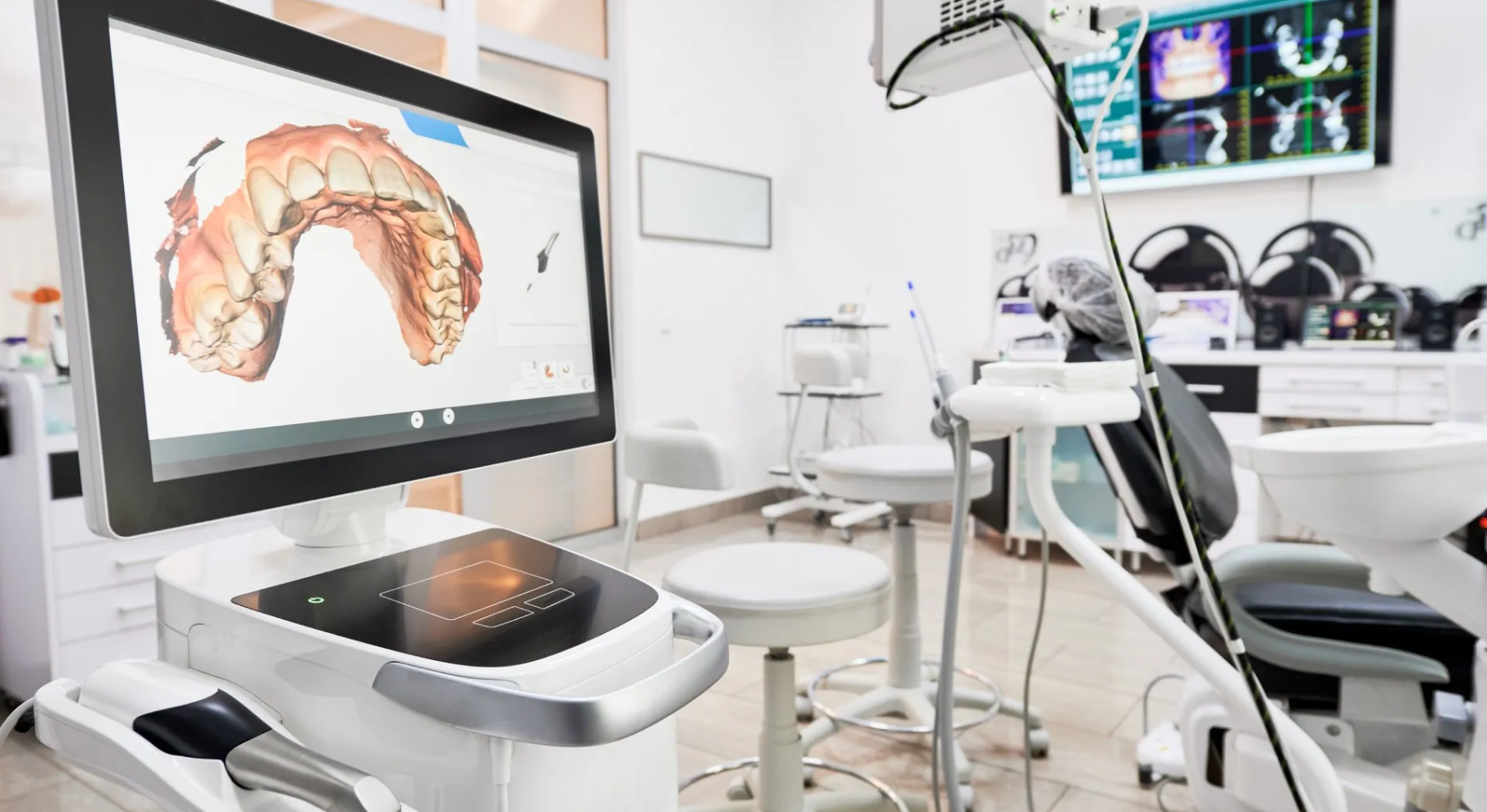 camera-intra-orale-dentiste-septeuil